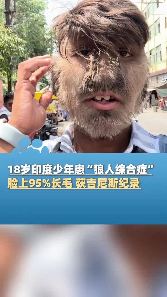 国产精品操大逼的相关介绍